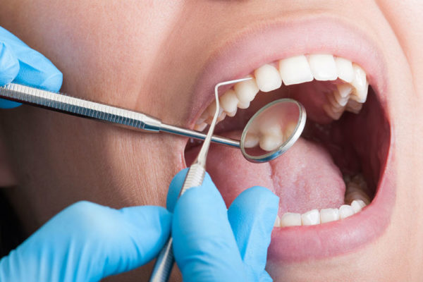 Periodoncia en Tirma López Clínica Dental