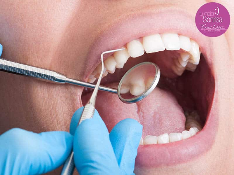 Qué es la periodoncia y qué tratamientos necesitas si sufres periodontitis