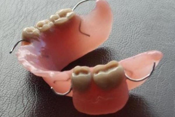 Consejos para cuidar mi prótesis dental