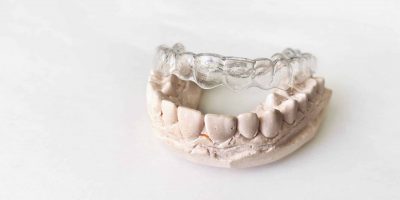 Beneficios de la ortodoncia invisible