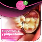 Pulpectomía (endodoncia infantil)