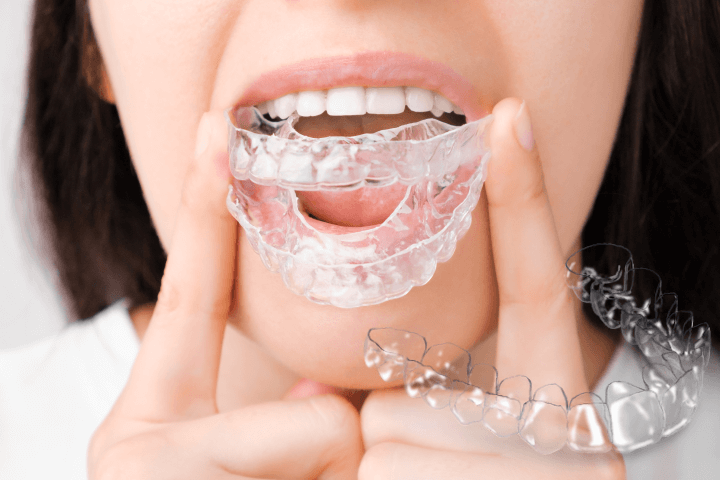 Ortodoncia Invisible Las Palmas Ortodoncia Invisible Las Palmas